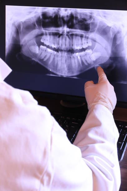Best Emergency Dental Care for Sports Injuries in Willow Park, TX